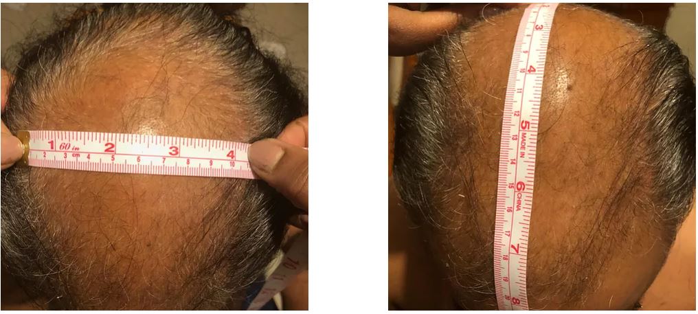 Replique Base Resizing 6 inches wide x 8 inches from Hairline to back of Crown